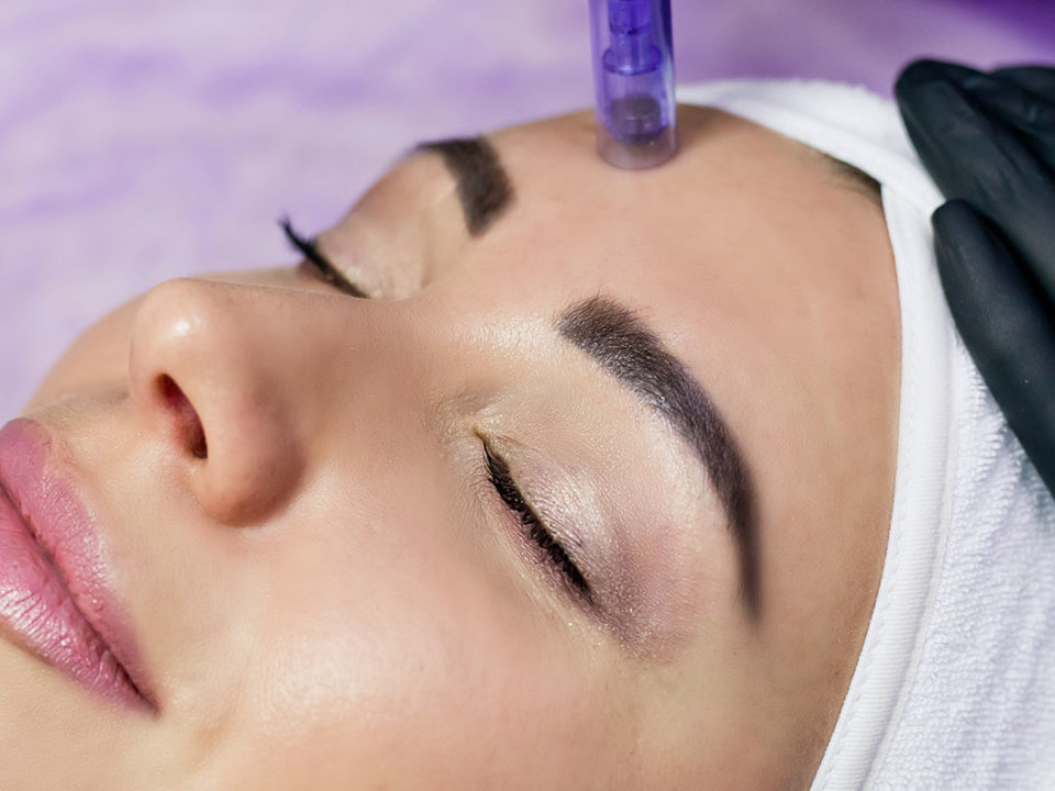 How Safe is Microneedling for Rejuvenating The Skin?
